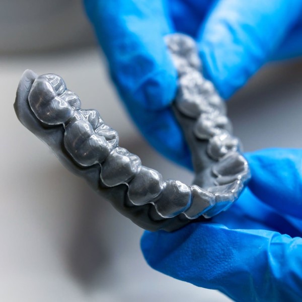 Khuôn cố định đăng trong suốt được in 3D theo từng cấu tạo răng của bệnh nhân
